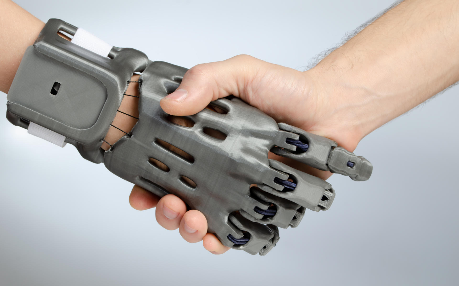 The Possibility of Using 3D Printing in Prosthetics 3D Quick Printing